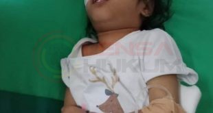 LensaHukum.co.id - Screenshot 20200622 001718 Gallery 310x165 - Balita Alifa Terkena Hidrosefalus Sejak Kecil diTinggal ibunya Butuh Perhatian Pemerintah